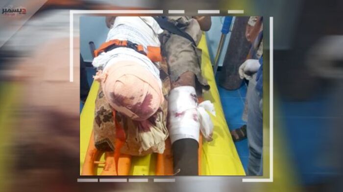 بتر قدمه اليمني.. انفجار لغم حوثي في مهندس بفريق مسام