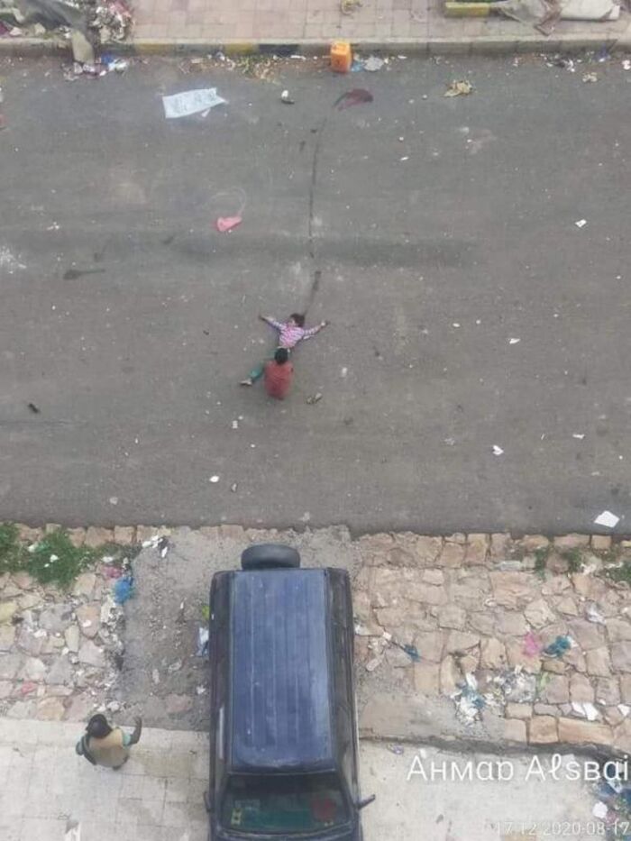 أطفال اليمن.. براءة تذبحها رصاص قناصة مليشيا الحوثي