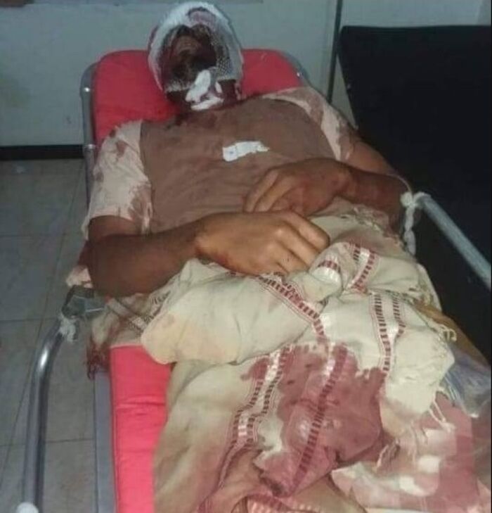 استشهاد بائع اسماك برصاص مشرف حوثي غربي تعز