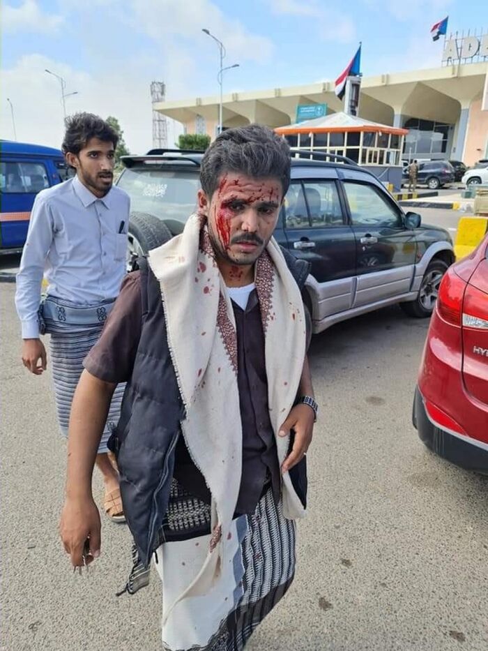 قيادي بالانتقالي: تفجير مطار عدن تم بقصف صاروخي