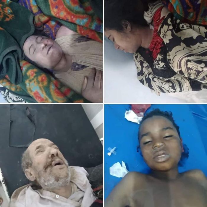 جريمة هزت البلاد.. استشهاد 12 مدنياً إثر تفجير مليشيا الحوثي لمنزلين في رداع "صورة"