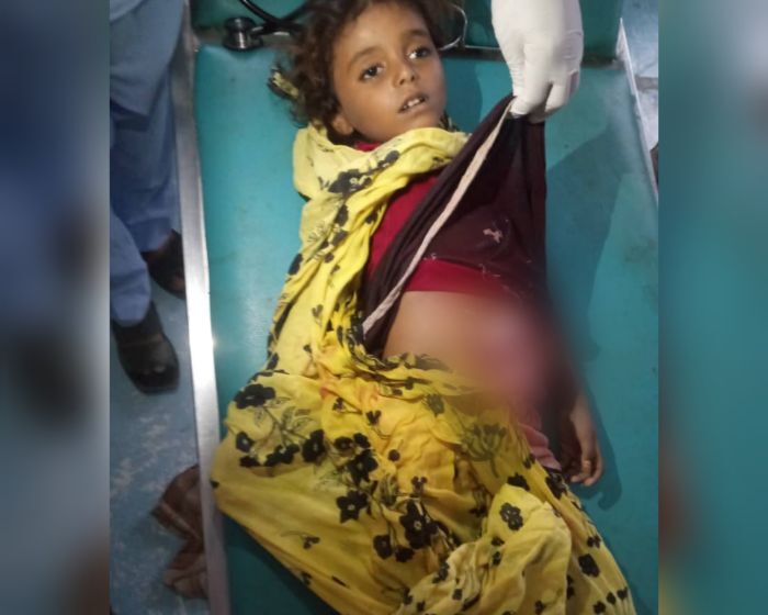 قصف مدفعي حوثي.. مقتل طفلة وإصابة فتاة في #الحديدة