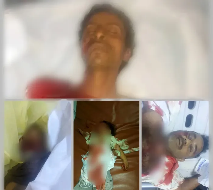 استشهاد 8 مدنيين بينهم أطفال في قصف حوثي استهدف تجمعًا لهم أثناء الإفطار في حجة