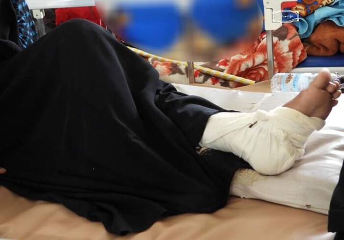 إصابة امرأة بقصف حوثي عشوائي على قرى شمال غربي الضالع