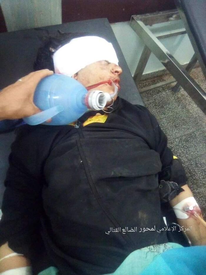 الضالع | إصابة امرأة برصاص قناص حوثي في الفاخر "صورة"
