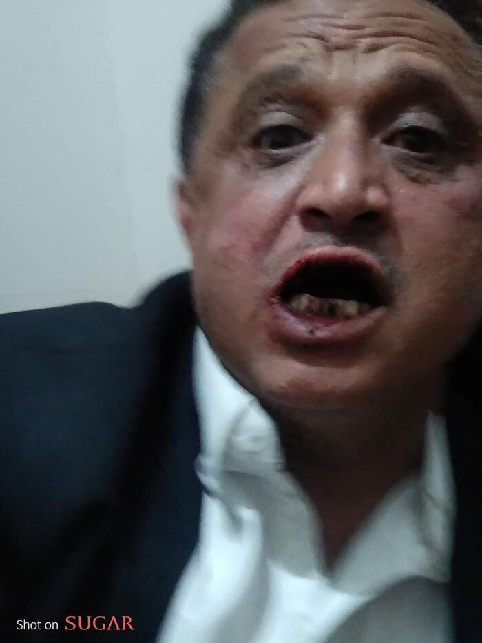 منظمة رايتس رادار تدين الاعتداء الحوثي على الصحفي مجلي الصمدي