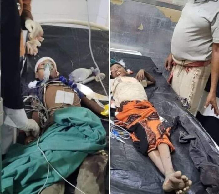 مقتل طفلين وإصابة 3 آخرين بانفجار مقذوف حوثي بلحج