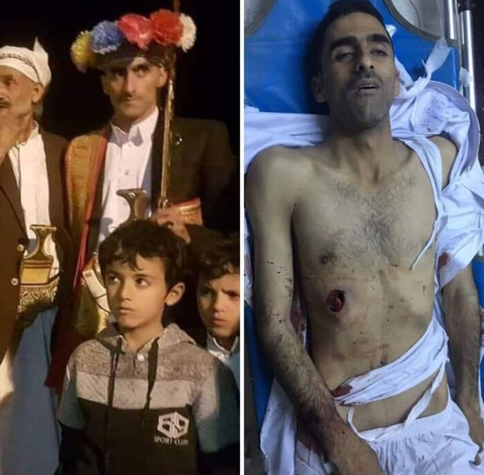 صورة وتفاصيل.. عمار الحطابي.. عريس يعدمه الحوثيين بسبب إشهار فرحته بالطريقة القبلية .. وسقوط 15 قتيل