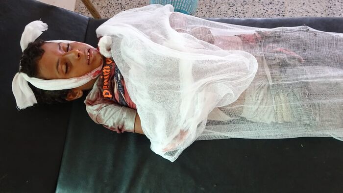 الحديدة.. مقتل طفل برصاصة قناص حوثي "صورة"
