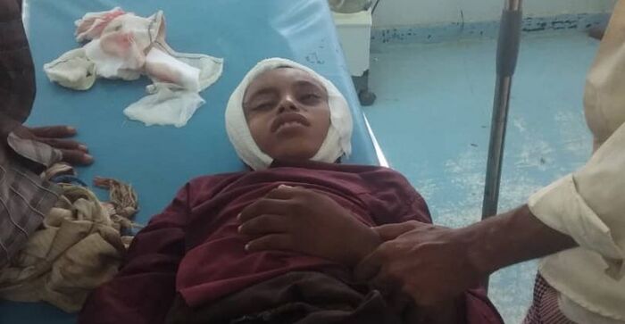#الحديدة.. إصابة طفل في الرأس برصاص قناص حوثي "صورة"