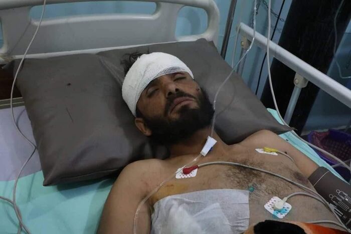 أسر قيادي حوثي بارز في جبهة الجوف "صورة"