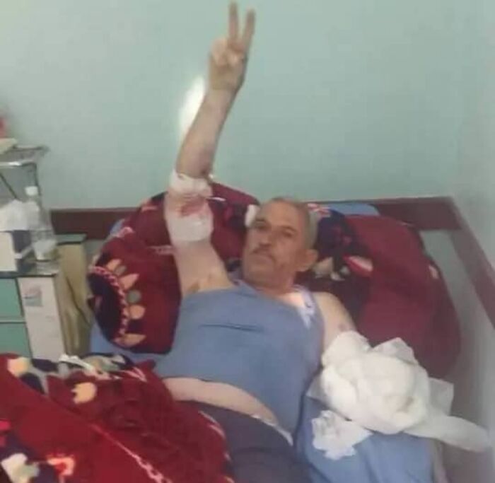 نجاة العميد الصيادي من محاولة اغتيال ونهب طقم عسكري في مأرب