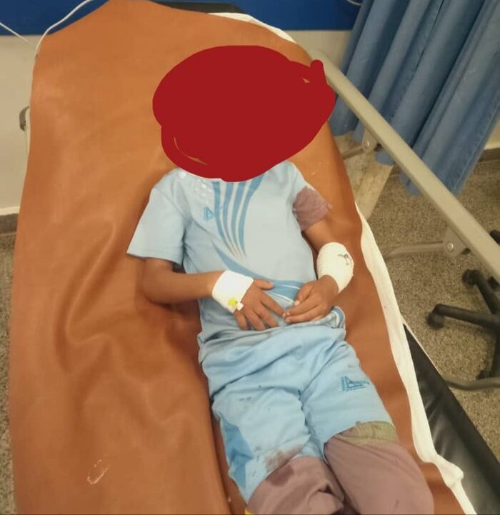 إصابة طفلين في الوازعية بانفجار مقذوف من مخلفات مليشيا الحوثي