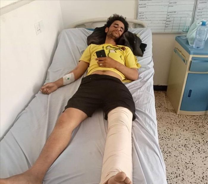 الضالع.. إصابة مواطن برصاص قناص حوثي قرب مناطق التماس مع إب