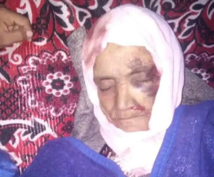 وفاة مسنّة وإصابة ابنتها جراء انهيار منزل في تعز