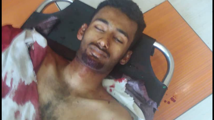 #تعز | إغتيال طالب جامعي وسط المدينة .. صورة