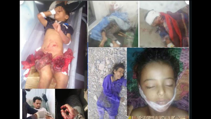 #الضالع | قرابة 10 ألف حالة إنتهاك بينها قتل وتفجير .. تقرير