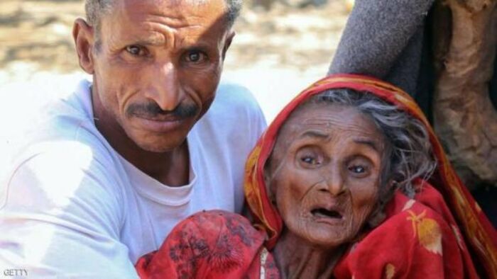 منظمات دولية تحذر : انعدام الأمن الغذائي يهدد 10 ملايين يمني
