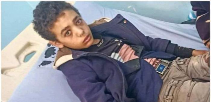 إصابة طفلين في اشتباكات عنيفة بمدينة إب "صورة"
