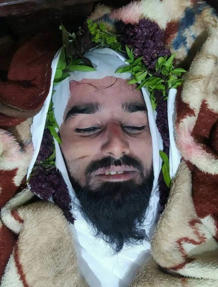 في إب المجاهدة.. الإثمد يرعب مليشيا الحوثي!!