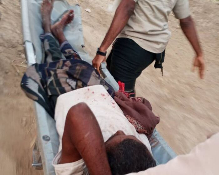 إصابة مواطن بجروح وبتر يده إثر قصف حوثي على ضواحي الحديدة