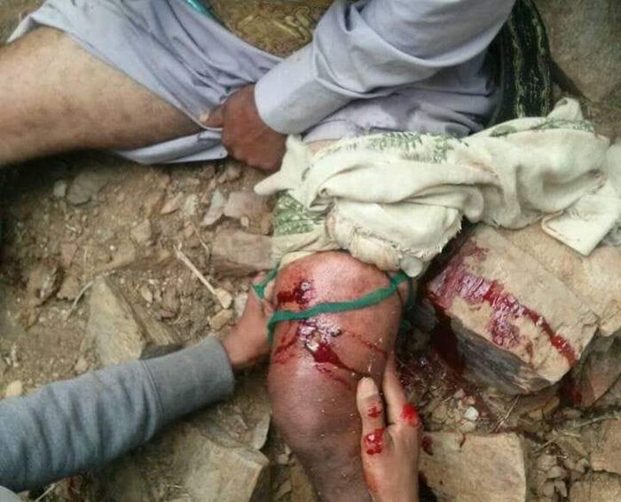 ميليشيا الحوثي تعتدي على رجل وزوجتة في حجة "صورة وتفاصيل"