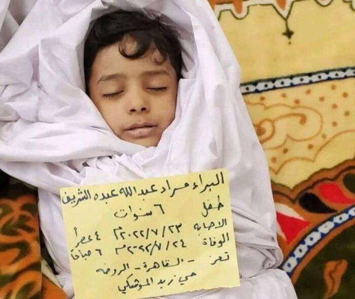 تعز.. وفاة طفل في مجزرة الحوثي بحي الروضة"صورة"
